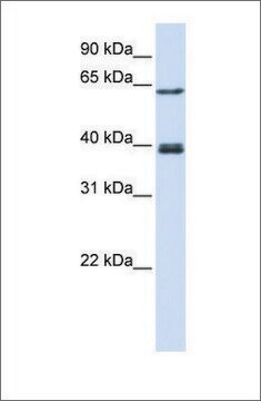 Anti-IKZF3 antibody produced in rabbit affinity isolated antibody