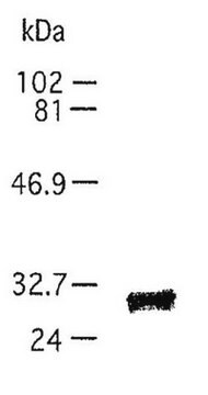 Anti-TIMP-1 (Ab-1) Mouse mAb (7-6C1) liquid, clone 7-6C1, Calbiochem&#174;