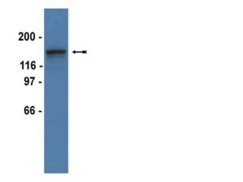 Anti-PDGFR&#946; Antibody, clone 4A56, rabbit monoclonal culture supernatant, clone 4A56, Upstate&#174;