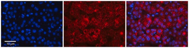 Anti-RER1 antibody produced in rabbit affinity isolated antibody