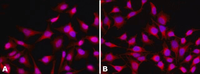 Anti-Histone Deacetylase 4 (HDAC4) (ML-19) antibody produced in rabbit affinity isolated antibody, buffered aqueous solution