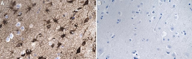 Anti-GLUL Antibody, clone 1D15 ZooMAb&#174; Rabbit Monoclonal recombinant, expressed in HEK 293 cells