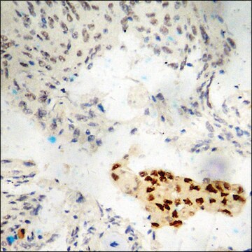 Anti-phospho-Estrogen Receptor-&#945; (pSer118) antibody produced in rabbit affinity isolated antibody