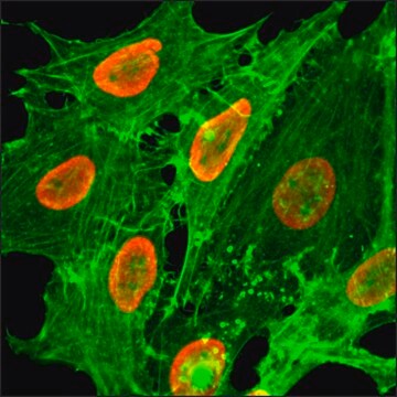 Anti-Acetyl-Histone H2B (Lys20) antibody, Rabbit monoclonal recombinant, expressed in HEK 293 cells, clone RM235, purified immunoglobulin