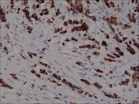 Anti-Cytokeratin 19 (CK-19) antibody, Rabbit monoclonal recombinant, expressed in HEK 293 cells, clone RM364, purified immunoglobulin