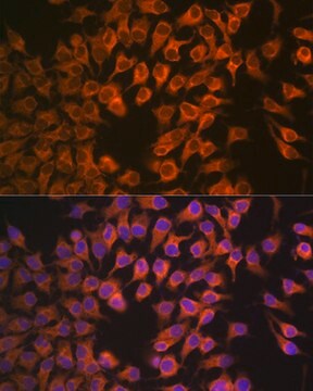 Anti-CYP17A1 Antibody, clone 5D2H1, Rabbit Monoclonal