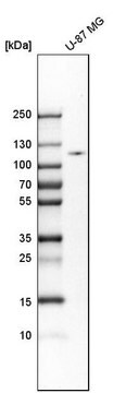 Anti-HK2 antibody produced in rabbit Prestige Antibodies&#174; Powered by Atlas Antibodies, affinity isolated antibody, buffered aqueous glycerol solution