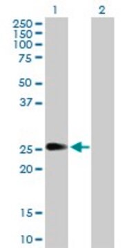 Anti-PIP5K1C antibody produced in rabbit purified immunoglobulin, buffered aqueous solution