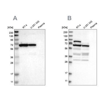 Anti-NOP58 antibody produced in rabbit Prestige Antibodies&#174; Powered by Atlas Antibodies, affinity isolated antibody, buffered aqueous glycerol solution