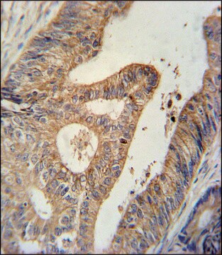 ANTI-BTG1 (CENTER) antibody produced in rabbit IgG fraction of antiserum, buffered aqueous solution