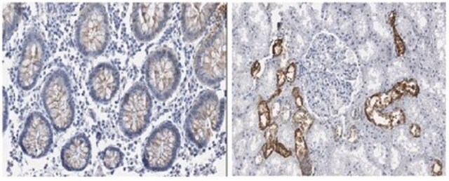 Anti-INK4a (p16) Antibody, clone 13H4.1 clone 13H4.1, from mouse