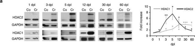 Anti-Histone Deacetylase 2 (HDAC2) antibody, Mouse monoclonal clone HDAC2-62, purified from hybridoma cell culture