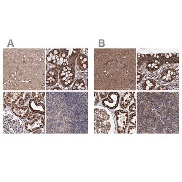 Anti-SUCLA2 antibody produced in rabbit Prestige Antibodies&#174; Powered by Atlas Antibodies, affinity isolated antibody, buffered aqueous glycerol solution