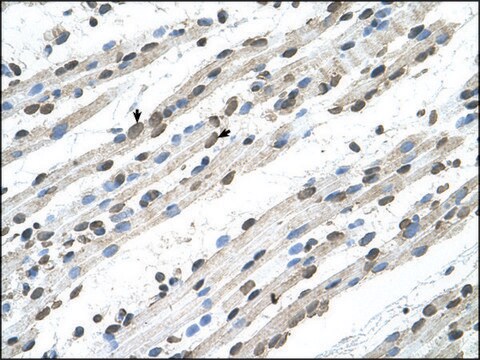 Anti-RCE1 antibody produced in rabbit IgG fraction of antiserum