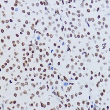 Anti-Acetyl-Histone H2B-K12 antibody produced in rabbit