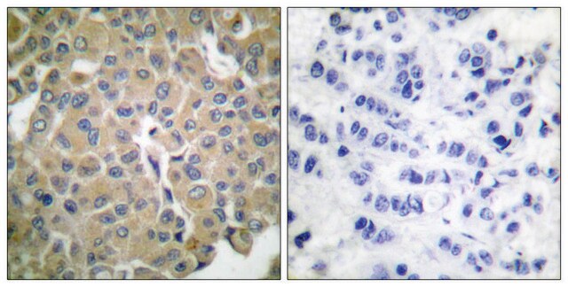 Anti-MART-1 antibody produced in rabbit affinity isolated antibody