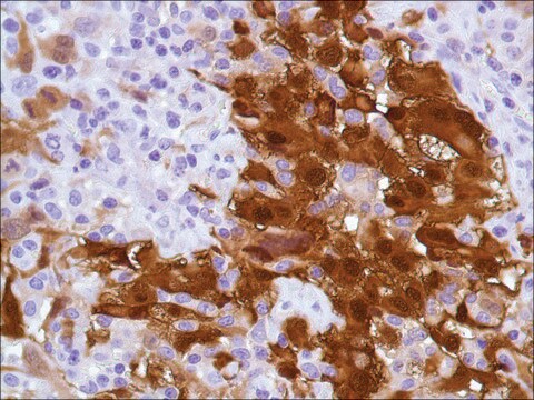 Anti-Calretinin antibody, Rabbit monoclonal clone SP13, recombinant, expressed in proprietary host, tissue culture supernatant