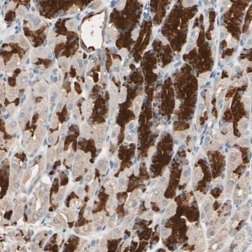 Anti-MAP3K7 antibody produced in rabbit Prestige Antibodies&#174; Powered by Atlas Antibodies, affinity isolated antibody, buffered aqueous glycerol solution