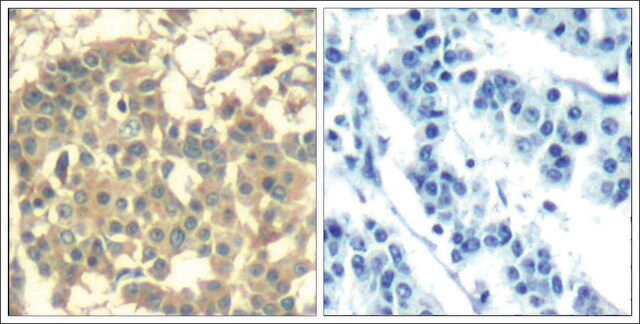 Anti-MET (Ab-1003) antibody produced in rabbit affinity isolated antibody