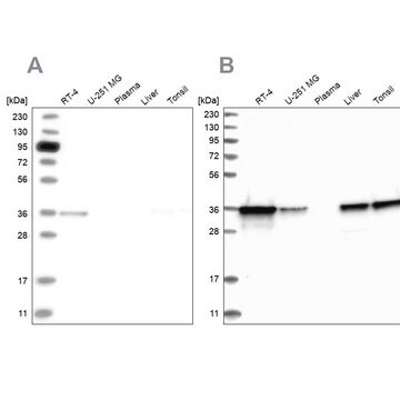 Anti-PDXK antibody produced in rabbit Prestige Antibodies&#174; Powered by Atlas Antibodies, affinity isolated antibody, buffered aqueous glycerol solution, ab3