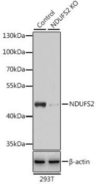 Anti-NDUFS2 antibody produced in rabbit