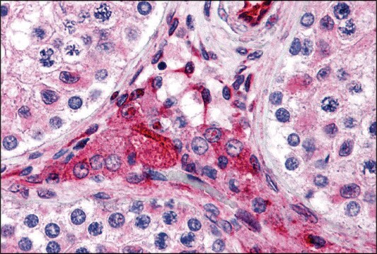 Anti-PTCHD2 antibody produced in rabbit affinity isolated antibody