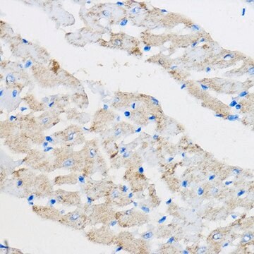 Anti-PPAR gamma antibody produced in rabbit