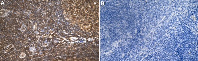 Anti-Profilin-1 Antibody, clone 1H21 ZooMAb&#174; Rabbit Monoclonal recombinant, expressed in HEK 293 cells