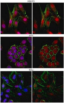 Anti-Smad4/DPC4 Antibody from rabbit, purified by affinity chromatography