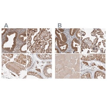 Anti-KYAT3 antibody produced in rabbit Prestige Antibodies&#174; Powered by Atlas Antibodies, affinity isolated antibody, buffered aqueous glycerol solution, Ab1