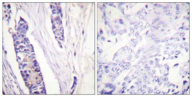 Anti-Tubulin &#946; antibody produced in rabbit affinity isolated antibody