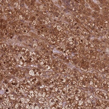 Anti-KIF26A antibody produced in rabbit Prestige Antibodies&#174; Powered by Atlas Antibodies, affinity isolated antibody, buffered aqueous glycerol solution