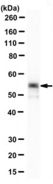 Anti-Cytokeratin-8 Antibody, clone 1E8