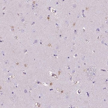 Anti-TMEM169 antibody produced in rabbit Prestige Antibodies&#174; Powered by Atlas Antibodies, affinity isolated antibody, buffered aqueous glycerol solution