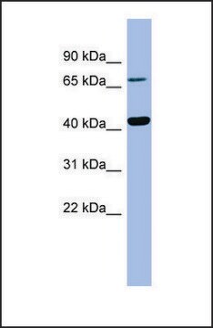 Anti-HPD antibody produced in rabbit affinity isolated antibody