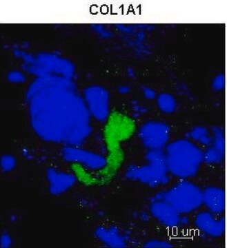 Anti-COL1A1 (C-terminal) antibody produced in rabbit affinity isolated antibody