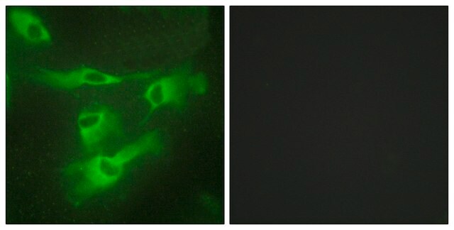 Anti-TNR4 antibody produced in rabbit affinity isolated antibody