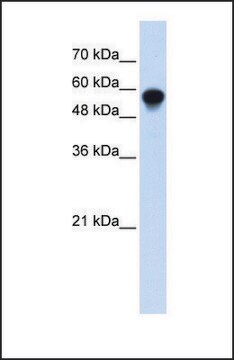 Anti-IRF6 antibody produced in rabbit affinity isolated antibody