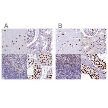 Anti-SUGP2 antibody produced in rabbit Prestige Antibodies&#174; Powered by Atlas Antibodies, affinity isolated antibody, buffered aqueous glycerol solution