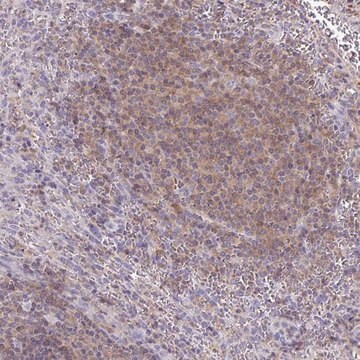 Anti-TNFAIP8 antibody produced in rabbit Prestige Antibodies&#174; Powered by Atlas Antibodies, affinity isolated antibody, buffered aqueous glycerol solution