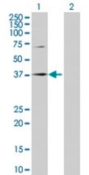 Anti-SPOP antibody produced in rabbit purified immunoglobulin, buffered aqueous solution