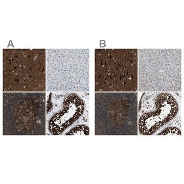 Anti-NUDCD3 antibody produced in rabbit Prestige Antibodies&#174; Powered by Atlas Antibodies, affinity isolated antibody, buffered aqueous glycerol solution, Ab1