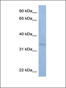 Anti-ST6GALNAC3 antibody produced in rabbit affinity isolated antibody