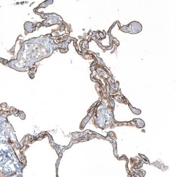 Anti-AGRN antibody produced in rabbit Prestige Antibodies&#174; Powered by Atlas Antibodies, affinity isolated antibody, buffered aqueous glycerol solution