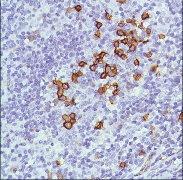 Anti-CD38 antibody, Rabbit monoclonal recombinant, expressed in proprietary host, clone SP149, tissue culture supernatant