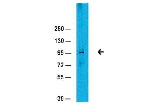 Anti-EZH2 Antibody serum, Upstate&#174;