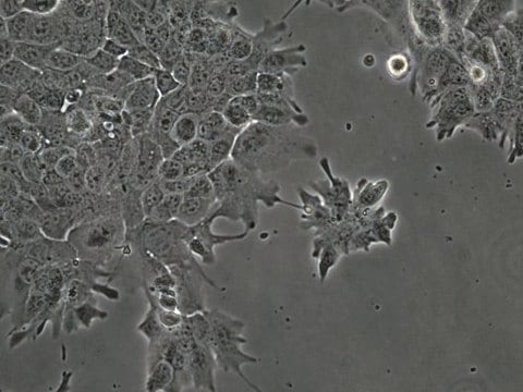 MOC22 Mouse Oral Squamous Cell Carcinoma (OSCC) Cell Line