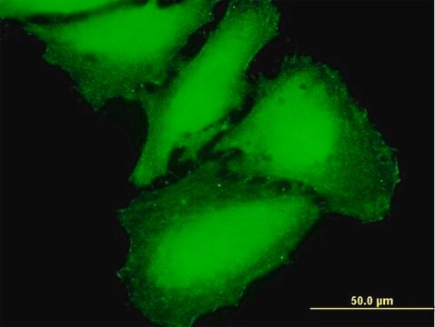 Anti-CAMK2G antibody produced in mouse IgG fraction of antiserum, buffered aqueous solution