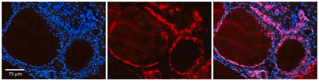 Anti-ID1 antibody produced in rabbit affinity isolated antibody