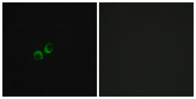 Anti-TAS1R3 antibody produced in rabbit affinity isolated antibody